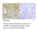 Product image for SYK (Ab-323) Antibody