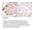 Product image for TNNI3 (Ab-22/23) Antibody