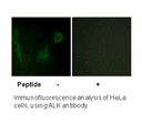 Product image for ALK (Ab-1604) Antibody