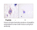 Product image for ALK (Ab-1604) Antibody