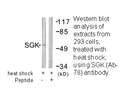 Product image for SGK (Ab-78) Antibody