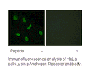 Product image for Androgen Receptor (Ab-94) Antibody