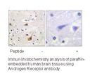 Product image for Androgen Receptor (Ab-94) Antibody