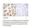 Product image for Arachidonate 5 Lipoxygenase (Ab-271) Antibody