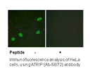 Product image for ATRIP (Ab-68/72) Antibody