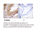 Product image for ATRIP (Ab-68/72) Antibody