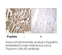 Product image for TNNI3 (Ab-43) Antibody