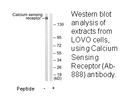 Product image for Calcium Sensing Receptor (Ab-888) Antibody