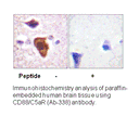 Product image for CD88/C5aR (Ab-338) Antibody