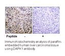 Product image for DAPK1 (Ab-308) Antibody