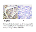 Product image for FAK (Ab-397) Antibody