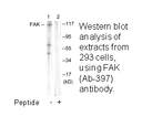 Product image for FAK (Ab-397) Antibody