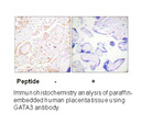 Product image for GATA3 (Ab-308) Antibody