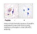 Product image for Interferon-&gamma; Receptor &alpha; chain (Ab-457) Antibody