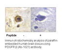 Product image for PDGFR &beta; (Ab-1021) Antibody