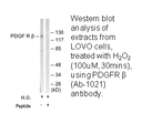 Product image for PDGFR &beta; (Ab-1021) Antibody