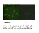 Product image for Retinoblastoma (Ab-249) Antibody