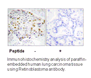 Product image for Retinoblastoma (Ab-249) Antibody