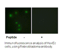 Product image for Retinoblastoma (Ab-826) Antibody