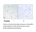 Product image for Retinoblastoma (Ab-826) Antibody