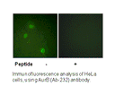 Product image for AurB (Ab-232) Antibody