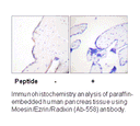 Product image for Moesin (Ab-558) Antibody