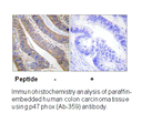 Product image for p47 phox (Ab-359) Antibody