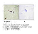 Product image for IGF2R (Ab-2409) Antibody