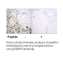 Product image for RBBP8 (Ab-664) Antibody