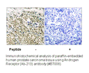 Product image for Androgen Receptor (Ab-213) Antibody