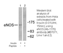 Product image for eNOS (Ab-1176) Antibody