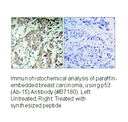 Product image for p53 (Ab-15) Antibody