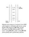 Product image for Retinoblastoma (Ab-780) Antibody