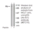 Product image for Retinoblastoma (Ab-807) Antibody