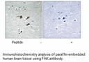 Product image for FAK (Ab-577) Antibody