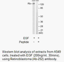 Product image for Retinoblastoma (Ab-252) Antibody