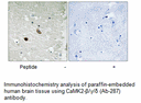 Product image for CaMK2-&beta;/&gamma;/&delta; (Ab-287) Antibody