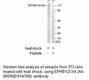 Product image for EPHB1/2/3/4 (Ab-600/602/614/596) Antibody