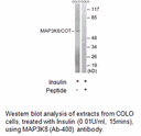 Product image for MAP3K8 (Ab-400) Antibody