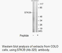 Product image for STK39 (Ab-325) Antibody
