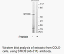 Product image for STK39 (Ab-311) Antibody