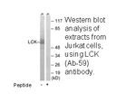 Product image for LCK (Ab-59) Antibody