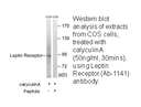 Product image for Leptin Receptor (Ab-1141) Antibody