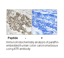 Product image for ATR (Ab-428) Antibody