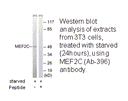 Product image for MEF2C (Ab-396) Antibody