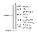 Product image for Actin-&gamma;2 Antibody