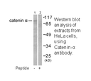 Product image for Catenin-&alpha;1 Antibody