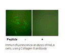 Product image for Collagen III Antibody