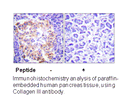 Product image for Collagen III Antibody