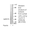 Product image for Cyclin G Antibody